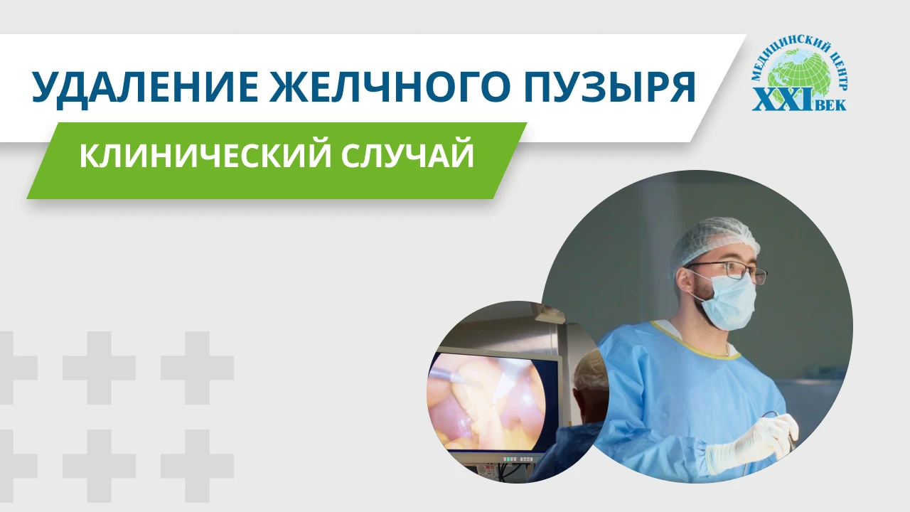 Удаление желчного пузыря